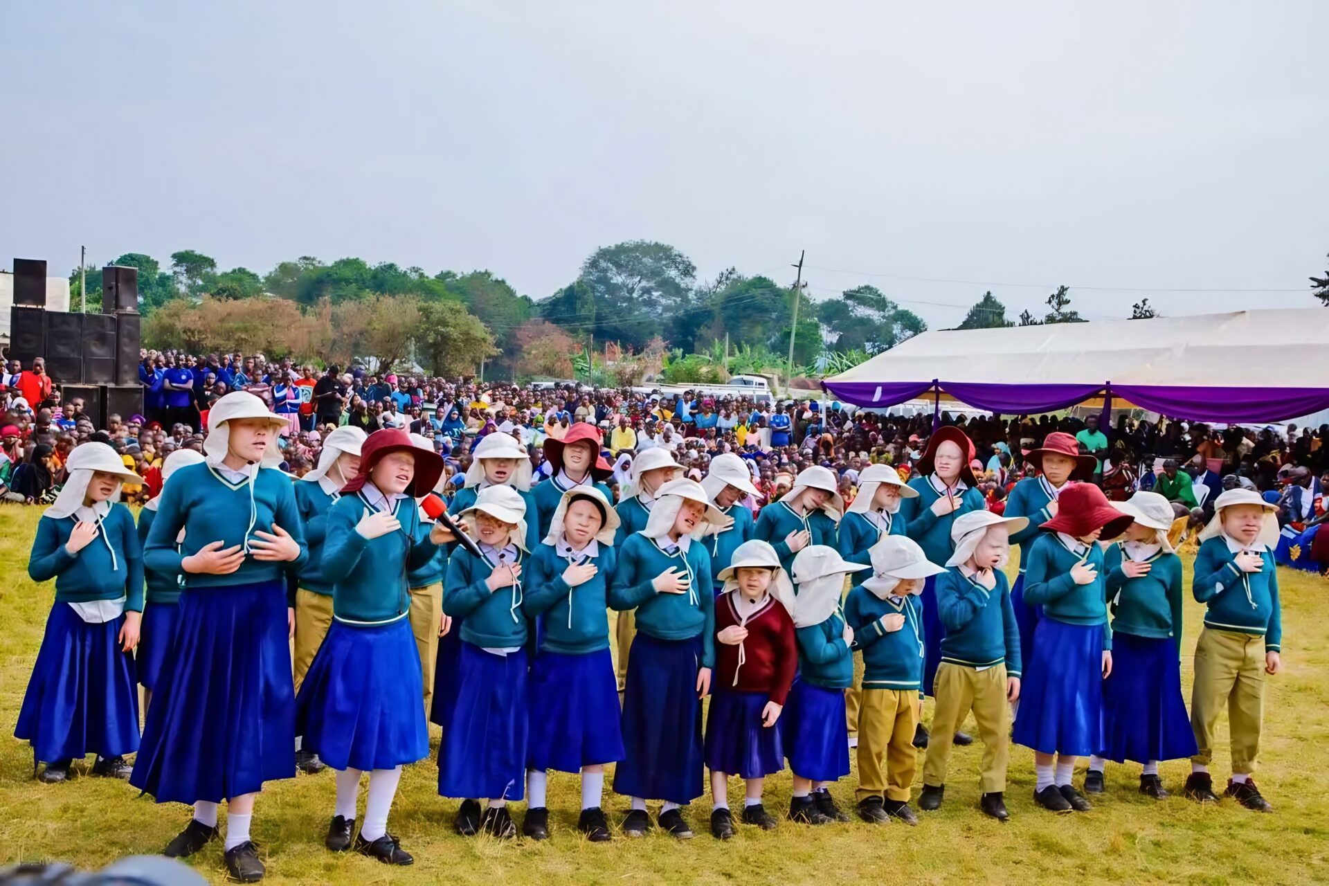 people with albinism people with albinism