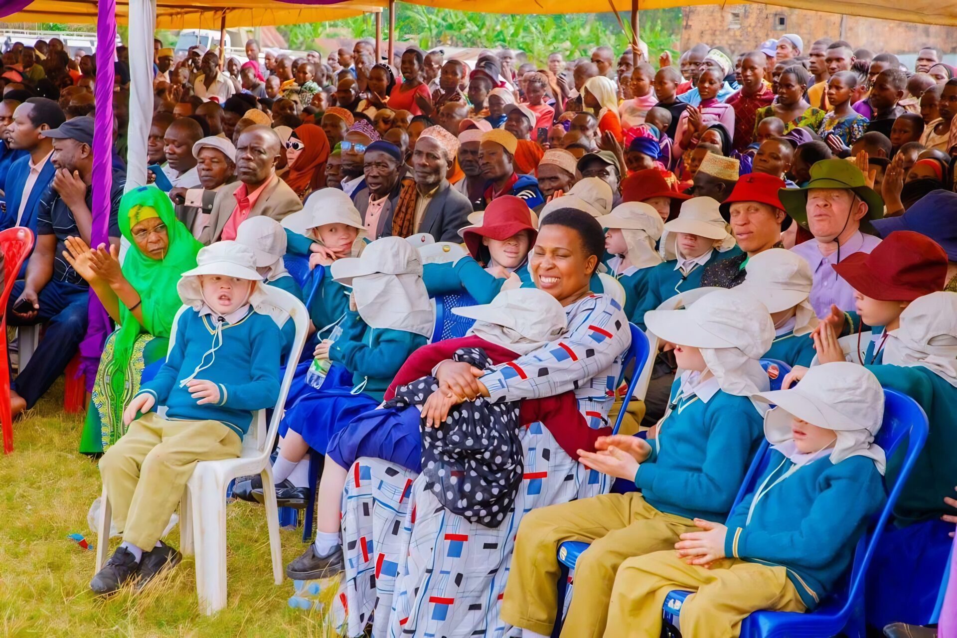people with albinism people with albinism